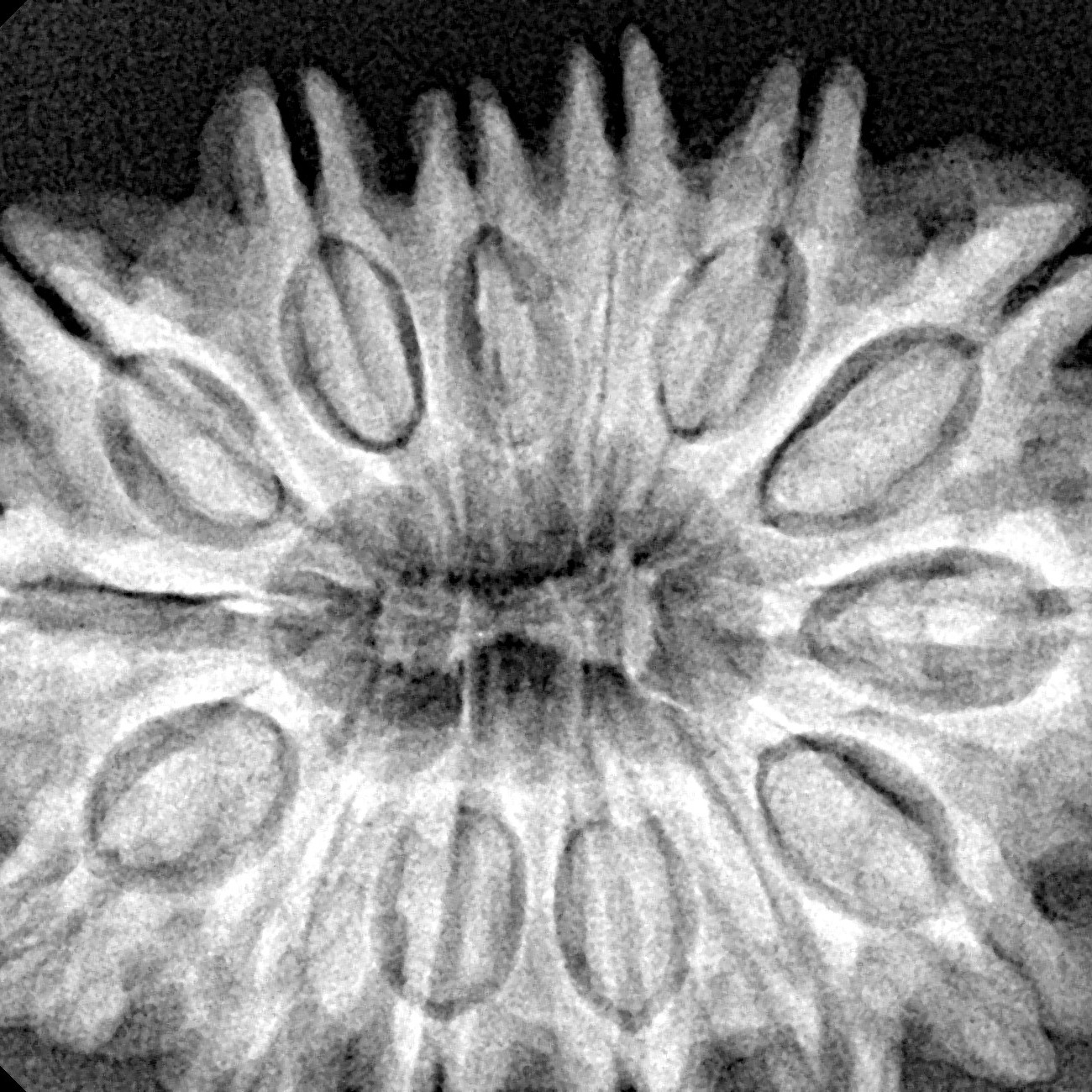 14 Mukhi Rudraksha 32.7mm 7.14gm - Xray