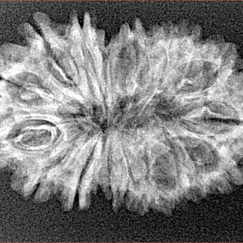 17 Mukhi Rudraksha 30.7mm 3.17gm - Xray