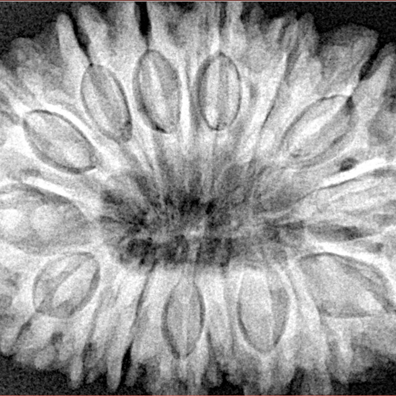 16 Mukhi Rudraksha 35.7mm 9.17gm - Xray