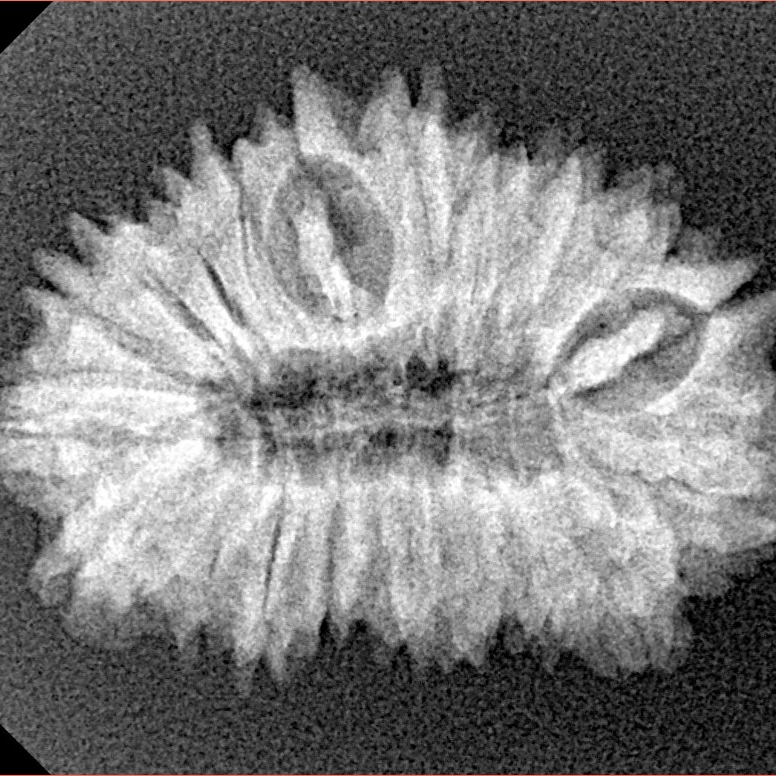 20 Mukhi Rudraksha 26.8mm 3gm - Xray