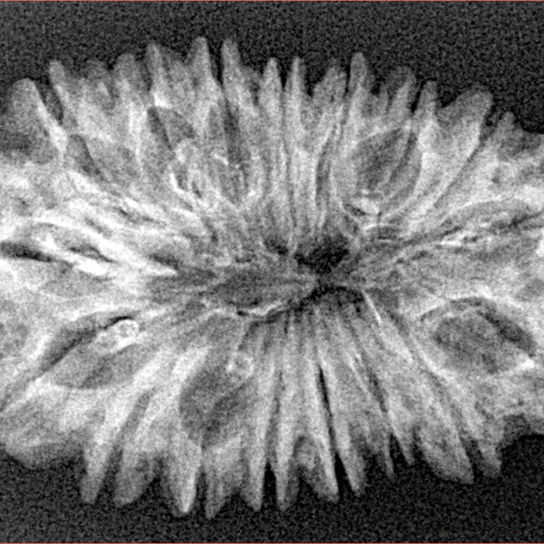 17 Mukhi Rudraksha 32.4mm 4.21gm - Xray