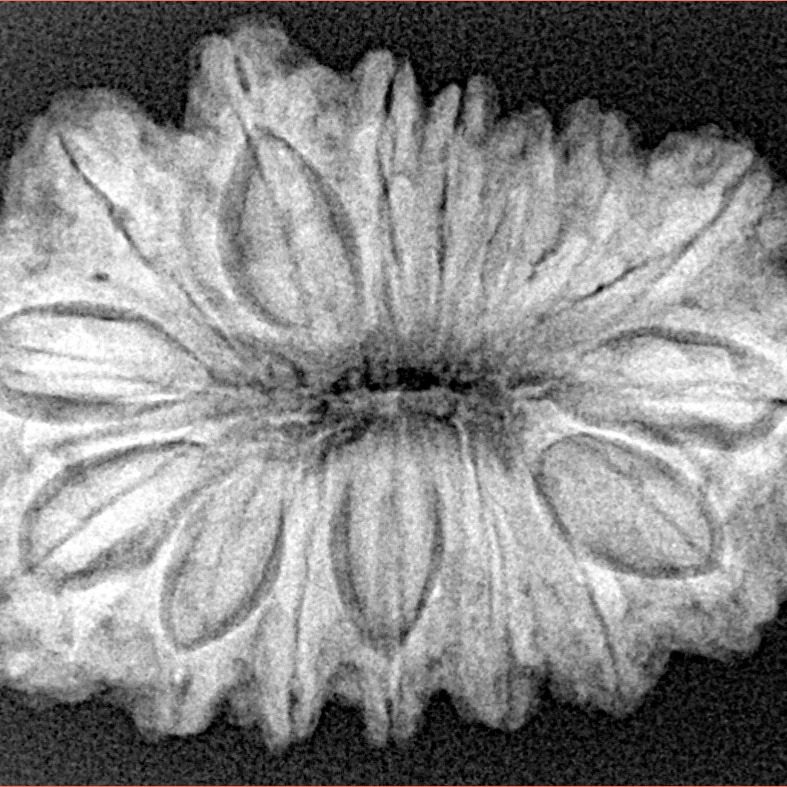 16 Mukhi Rudraksha 32.2mm 5.75gm - Xray