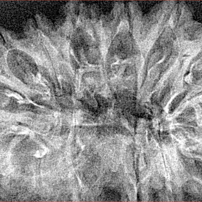 16 Mukhi Rudraksha 40.2mm 3.8gm - Xray