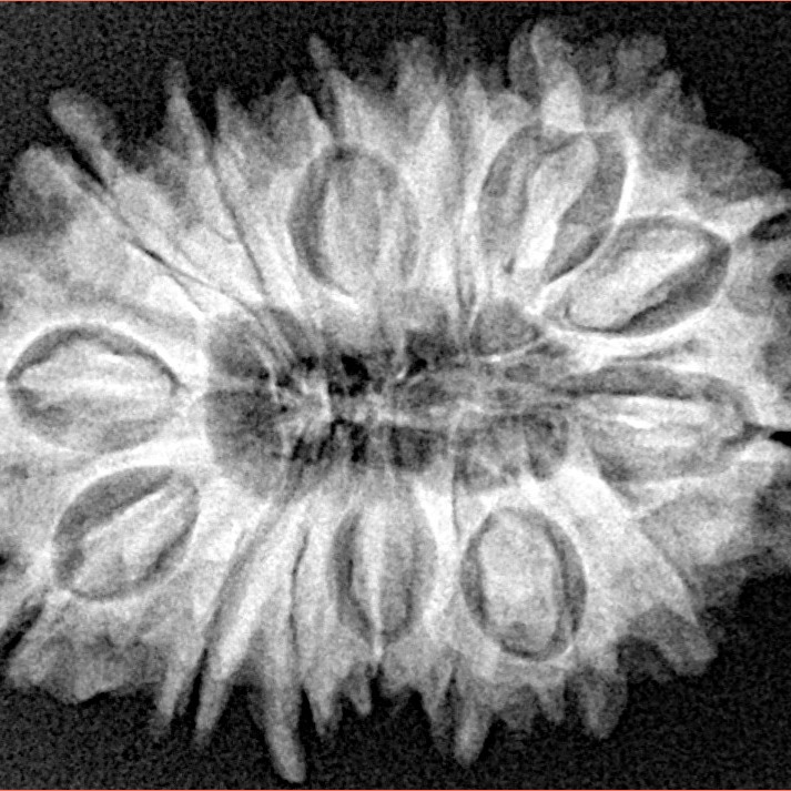 16 Mukhi Rudraksha 27.6mm 4.46gm - Xray