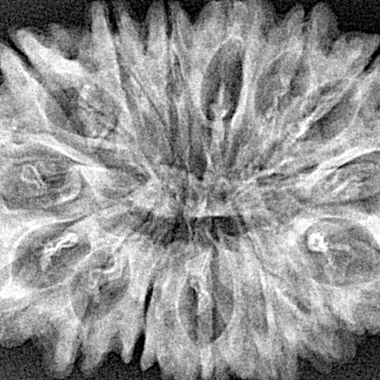 15 Mukhi Rudraksha 35.3mm 5.9gm - Xray