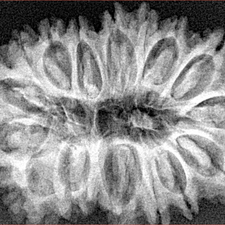 17 Mukhi Rudraksha 32.4mm 5.48gm - Xray