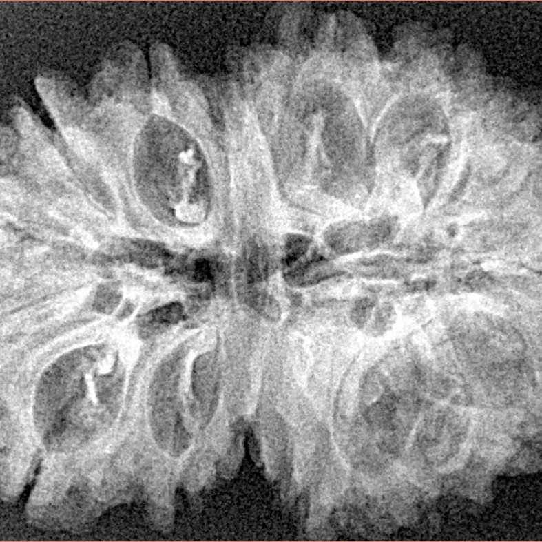 16 Mukhi Rudraksha 33.6mm 5.53gm - Xray