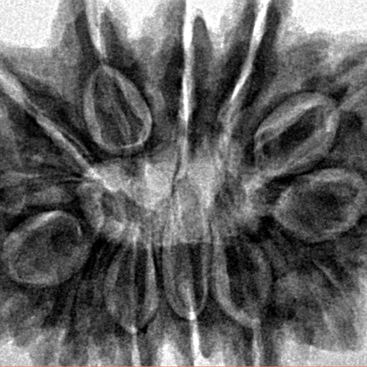 13 Mukhi Rudraksha 32.1mm 7.45gm - Inverse xray