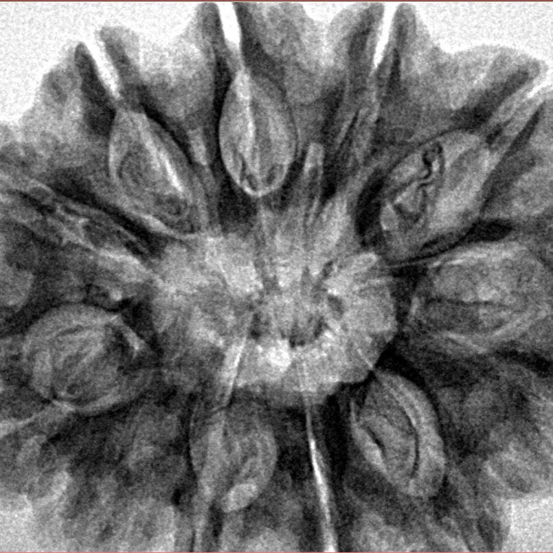 12 Mukhi Rudraksha 33mm 7.42gm - Inverse xray