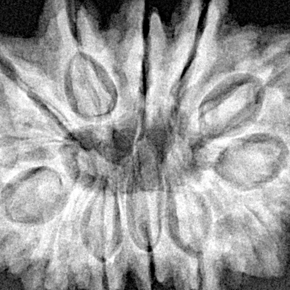 13 Mukhi Rudraksha 32.1mm 7.45gm - Xray