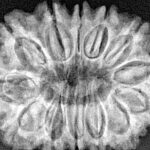 13 Mukhi Rudraksha 30.1mm 5.64gm - Xray