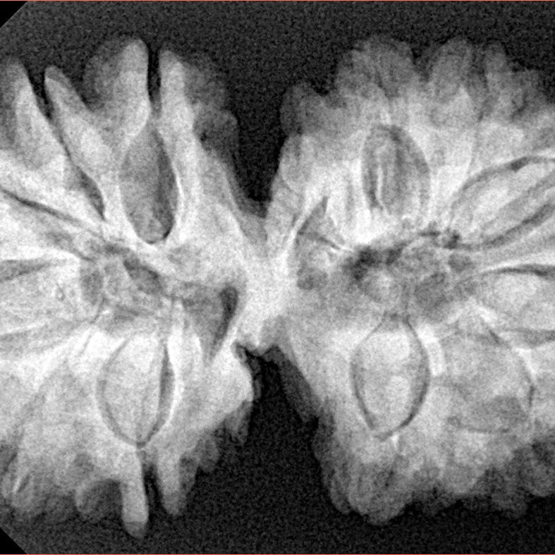 14 Mukhi Gaurishankar 36.4mm 7.63gm - Xray