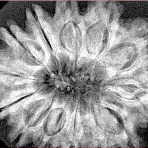 13 Mukhi Rudraksha 33.1mm 7.27gm - Xray