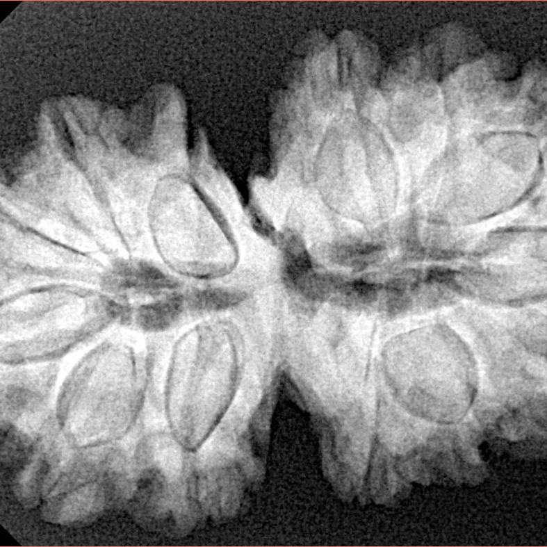 14 Mukhi Gaurishankar 34.2mm 6.68gm - Xray