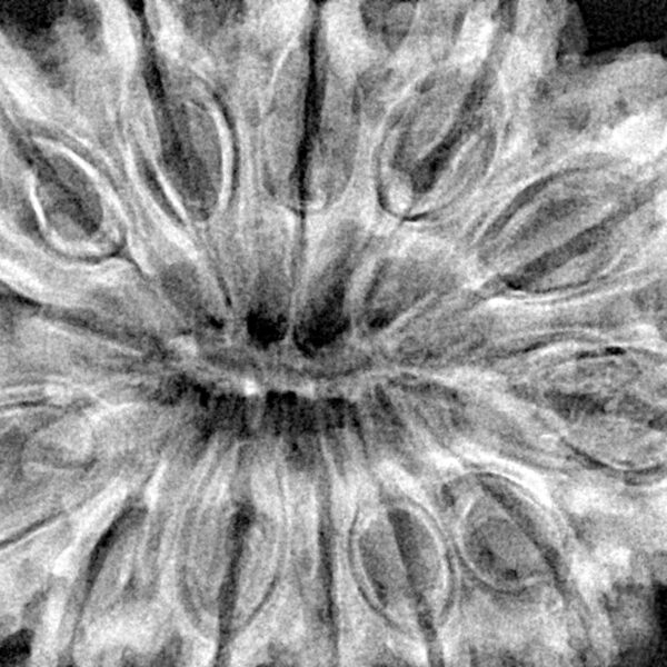 13 Mukhi Rudraksha 39.1mm 9.9gm - Xray