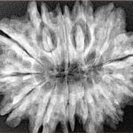 13 Mukhi Rudraksha 31.6mm 6.19gm - Xray