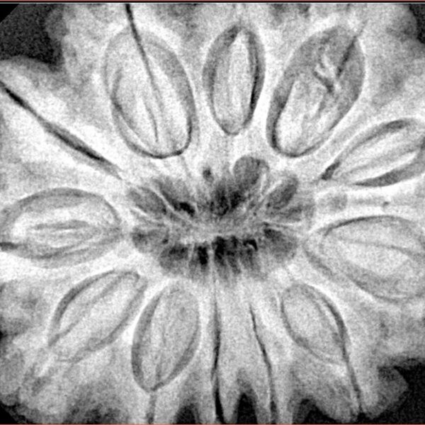 12 Mukhi Rudraksha 34.6mm 10.15gm - Xray