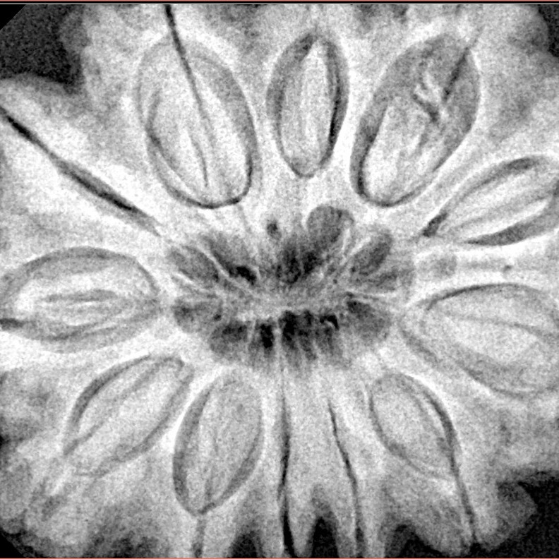 12 Mukhi Rudraksha 34.6mm 10.15gm - Xray