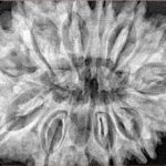 13 Mukhi Rudraksha 34.6mm 8gm - Xray