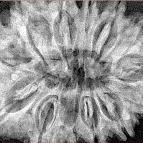 13 Mukhi Rudraksha 34.6mm 8gm - Xray