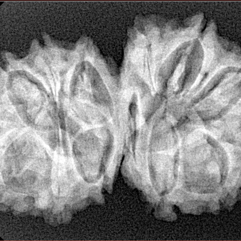 14 Mukhi Gaurishankar 33.3mm 5.87gm - Xray