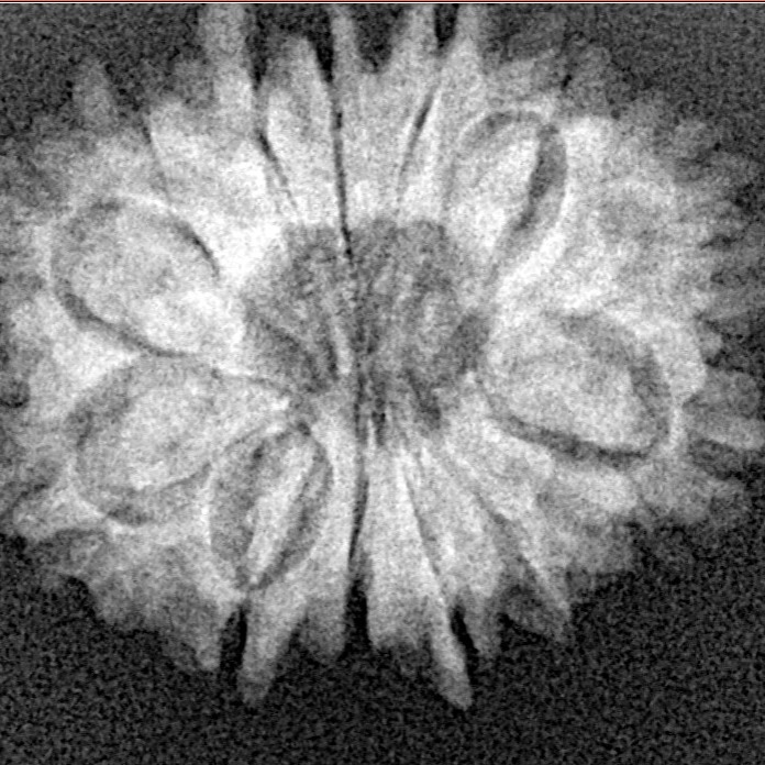 13 Mukhi Rudraksha 23.4mm 3.25gm - Xray