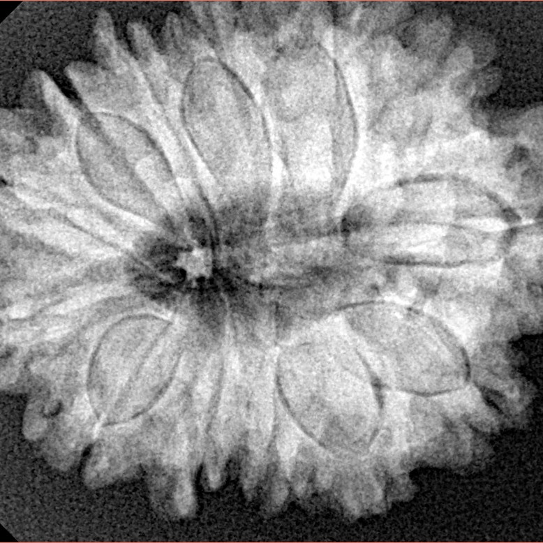 13 Mukhi Rudraksha 29.8mm 6.12gm - Xray