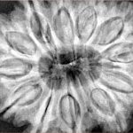 12 Mukhi Rudraksha 35.8mm 10.16gm - Xray