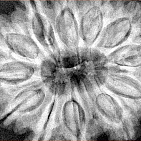 12 Mukhi Rudraksha 35.8mm 10.16gm - Xray