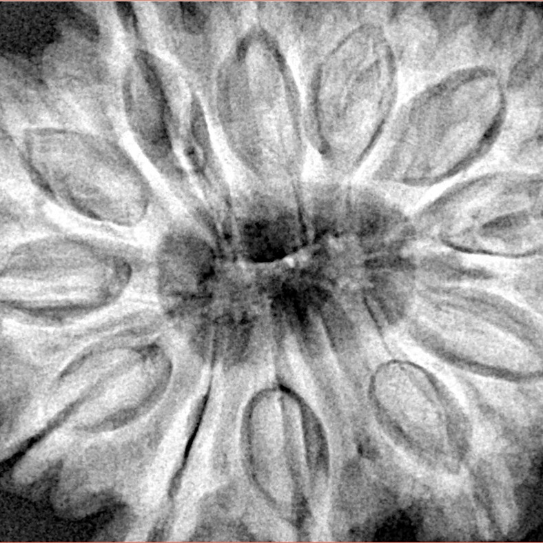 12 Mukhi Rudraksha 35.8mm 10.16gm - Xray