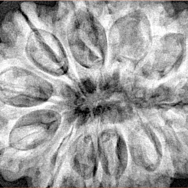 12 Mukhi Rudraksha 34.7mm 9.42gm - Xray