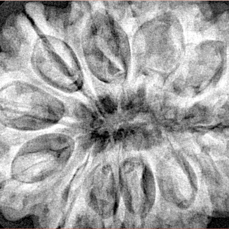 12 Mukhi Rudraksha 34.7mm 9.42gm - Xray