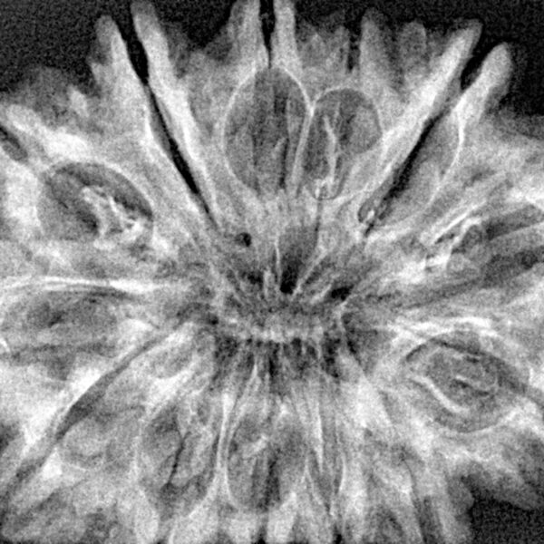 13 Mukhi Rudraksha 34.4mm 6.2gm - Xray