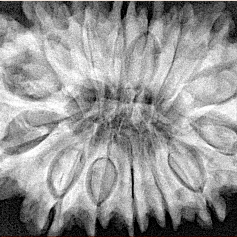 15 Mukhi Rudraksha 34.3mm 8.3gm - Xray