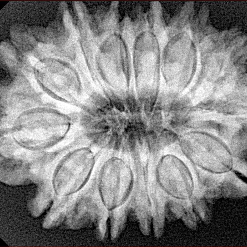 13 Mukhi Rudraksha 31.4mm 6.25gm - Origin: Nepal - Xray
