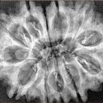 12 Mukhi Rudraksha 33.2mm 4.91gm - Xray