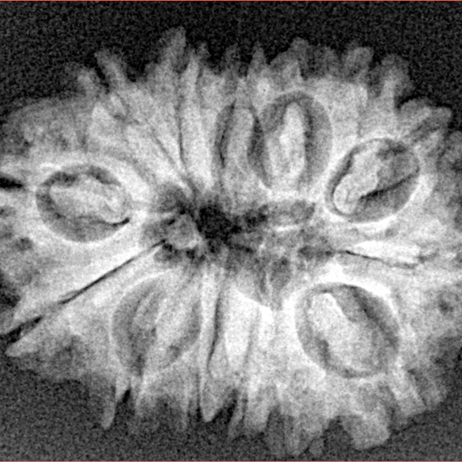 14 Mukhi Rudraksha 24.4mm 3.15gm - Xray