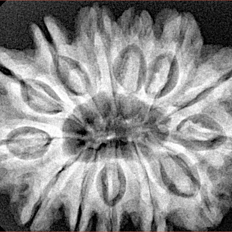 13 Mukhi Rudraksha 32.1mm 7.11gm - Xray