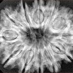 12 Mukhi Rudraksha 32.3mm 6.23gm - Xray