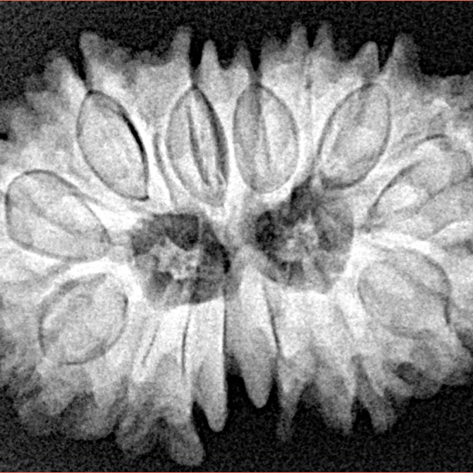 14 Mukhi Rudraksha 27.9mm 4.42gm - Xray