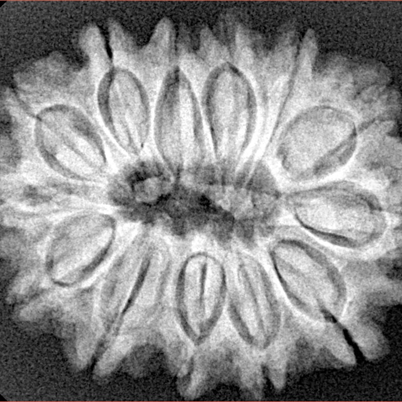 13 Mukhi Rudraksha 29.6mm 5.79gm - Xray