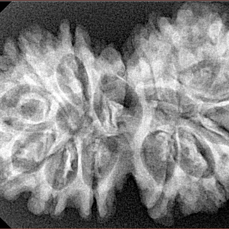 14 Mukhi Gaurishankar 35.6mm 6gm - Xray