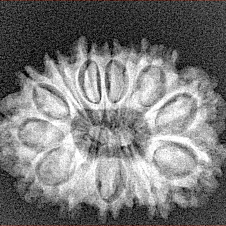 14 Mukhi Rudraksha 25.2mm 3.13gm - Xray