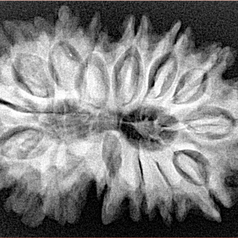 15 Mukhi Rudraksha 33.8mm 5.79gm - Xray