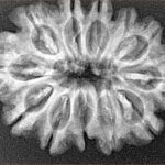 12 Mukhi Rudraksha 29.1mm 4.71gm - Xray