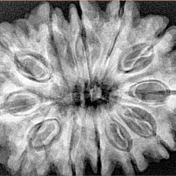 12 Mukhi Rudraksha 33.7mm 7.07gm - Xray