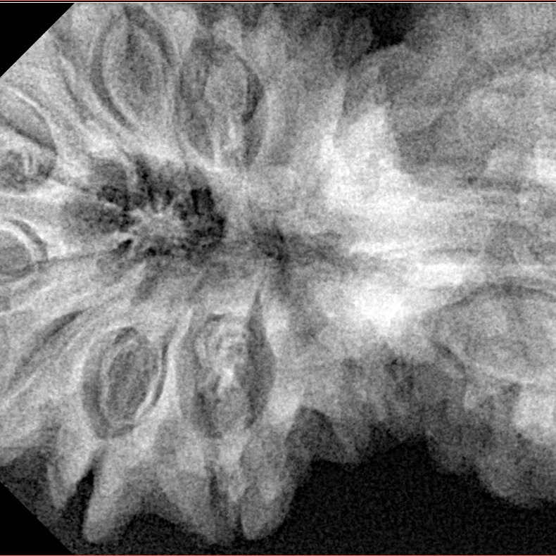 14 Mukhi Gaurishankar 45.2mm 10.69gm - Xray