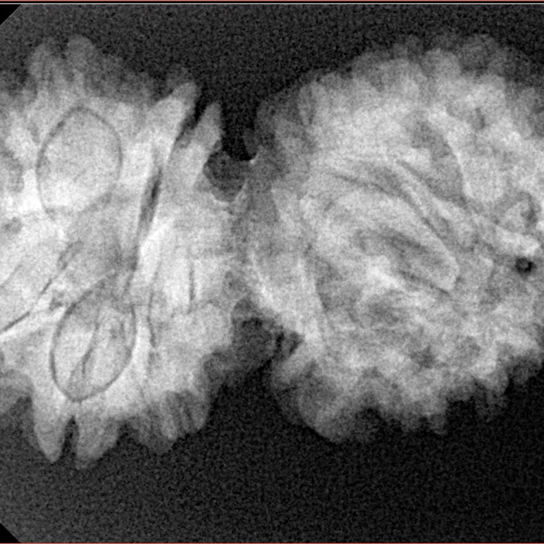 14 Mukhi Gaurishankar 33.5mm 5.53gm - Xray
