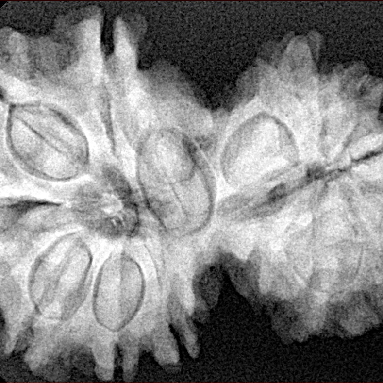 14 Mukhi Gaurishankar 35mm 7.22gm - Xray