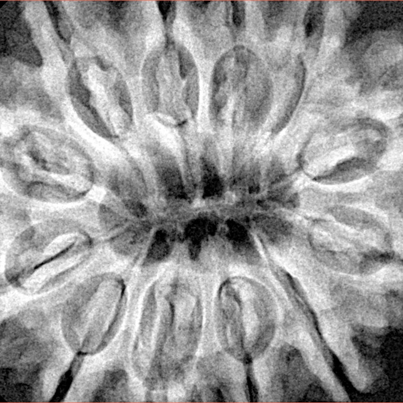 12 Mukhi Rudraksha 34.4mm 8.34gm - Xray